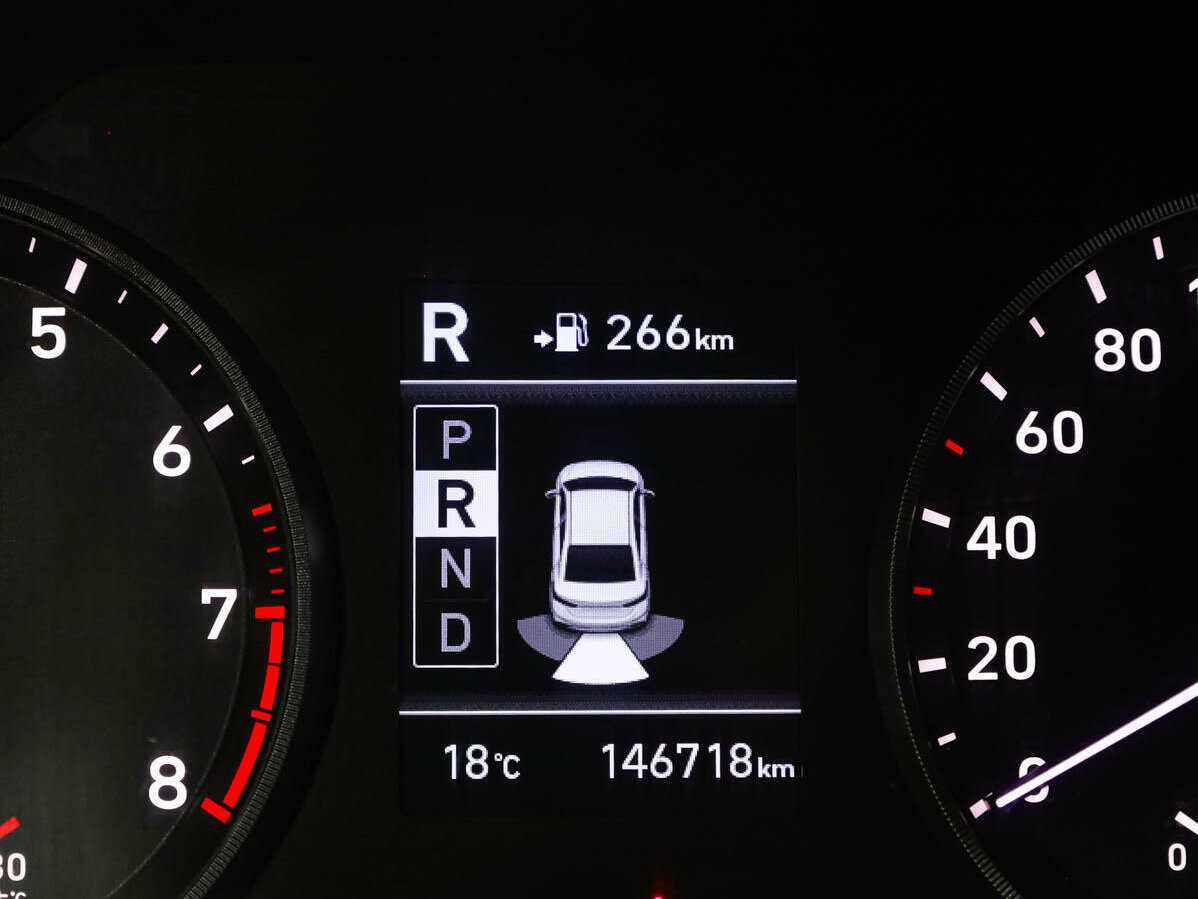 Hyundai Solaris с пробегом — 2018 год. Фото: #10